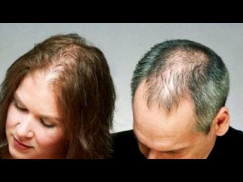Clínica de Estética disponibiliza tratamentos para calvície